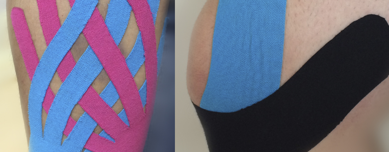 Comment utiliser le Kinesio Taping en prévention des blessures courantes ?