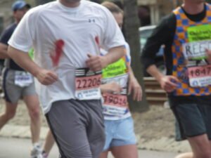 Course à pied et irritations de la peau : Comment les éviter en 3 étapes simples