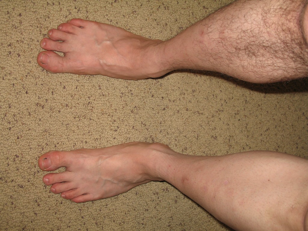 2 jambes d'homme dont une rasée