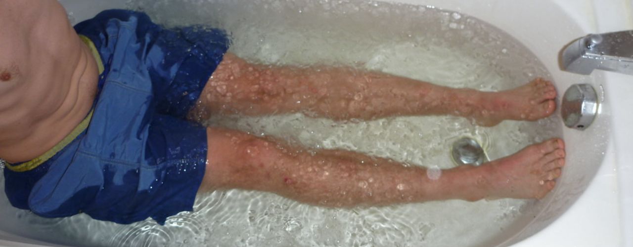 Les bains glacés améliorent-ils vraiment la récupération musculaire ?