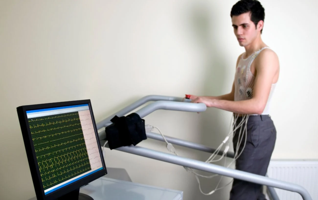 Le test protocole de Bruce sur tapis de course : Comment estimer votre VO2 Max ?