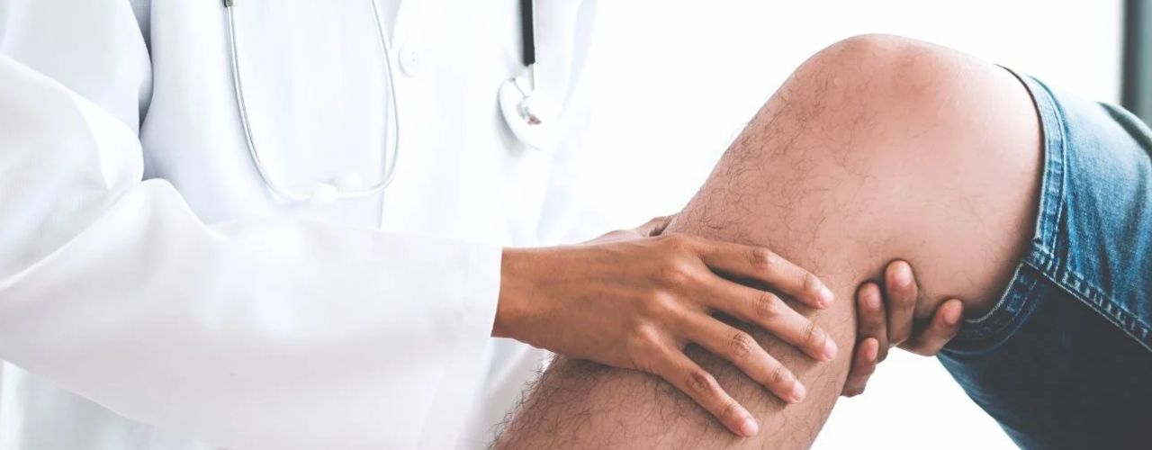 Combien de temps faut-il pour guérir d’une fracture de stress ?