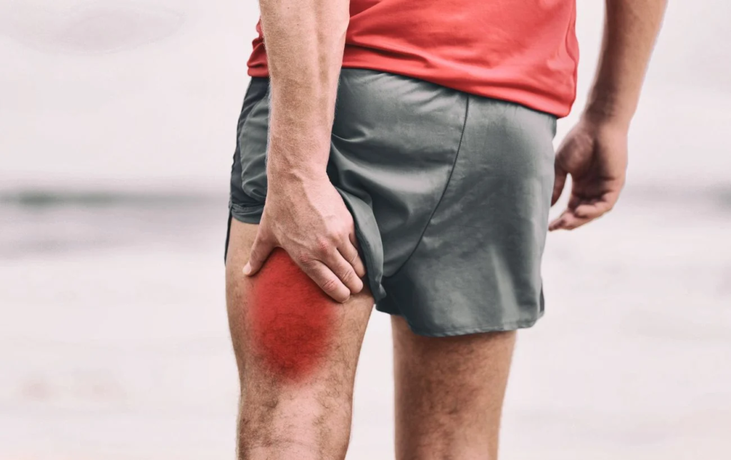 Puis-je courir avec une élongation des ischio-jambiers ? + Comment récupérer correctement ?