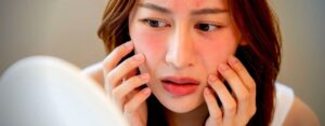 Visage rouge après l'activité physique ? 3 causes + conseils d'experts pour soulager