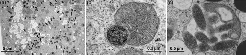 Mitochondries visibles au microscope