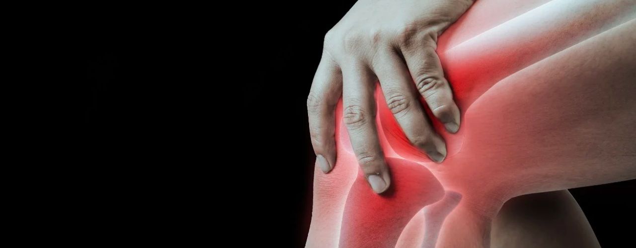 Syndrome de la bandelette ilio-tibiale chez les coureurs : Causes, symptômes et traitement
