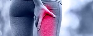 10 exercices pour soulager le syndrome du piriforme
